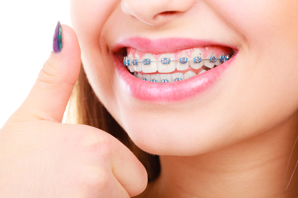 orthodontics