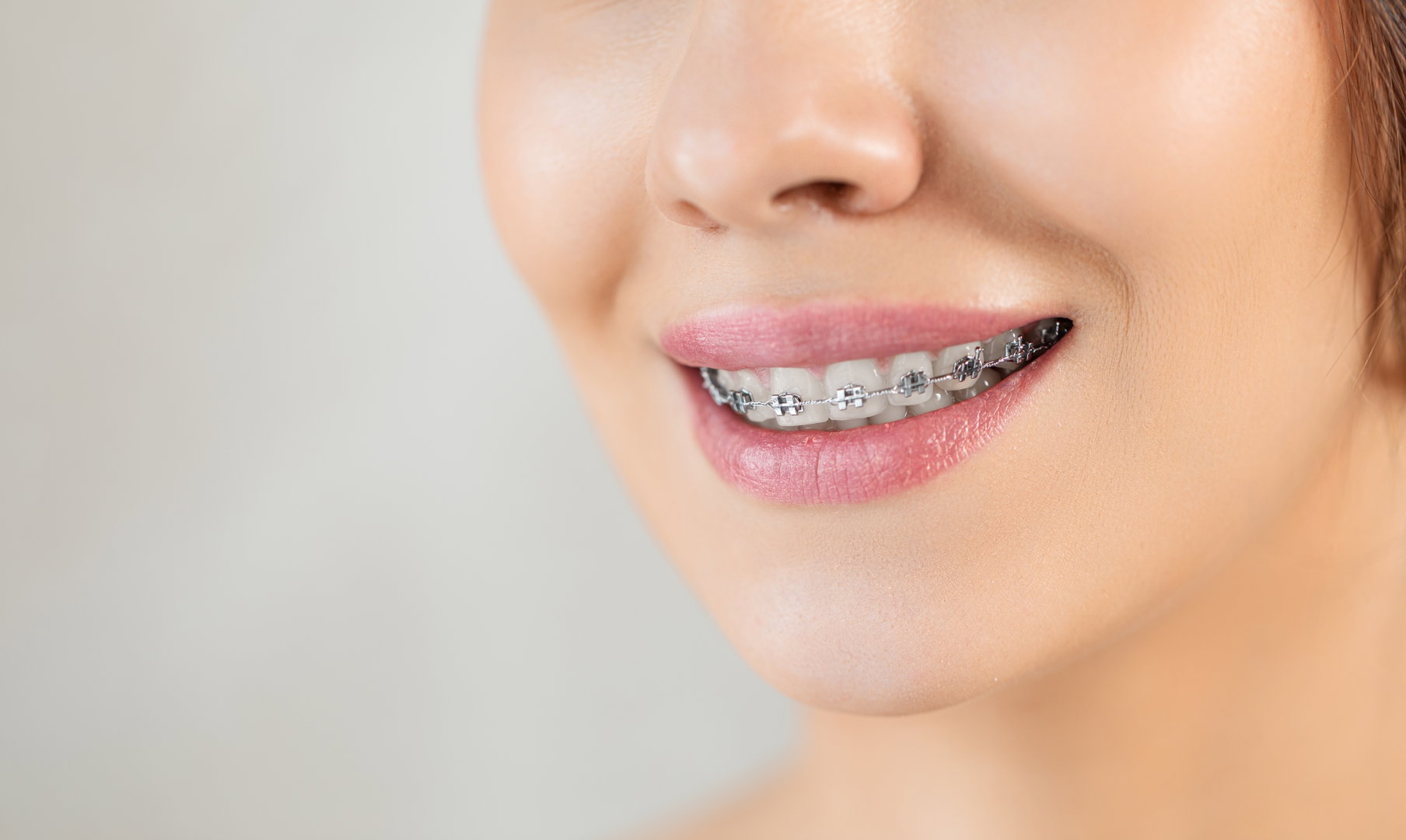 ortho-treatment4